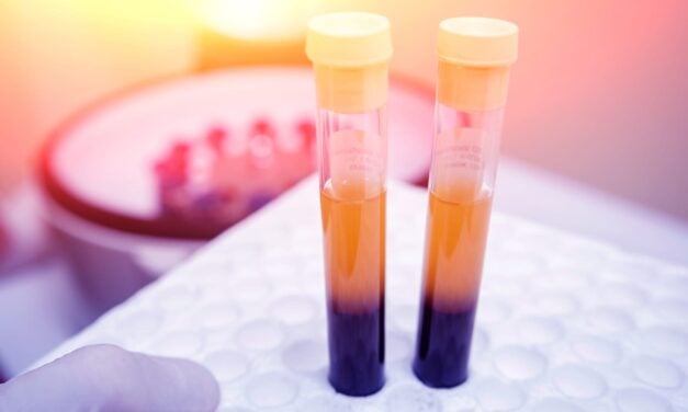 The Power of High-Sensitivity Troponin in Rapid Testing of Cardiovascular Disease 