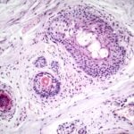 FDA Grants Breakthrough Device Designation to AI-Powered Dermatopathology Solution