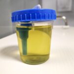 Standardizing Urine Collection Reduced Workflow Disruptions at Middlesex Health