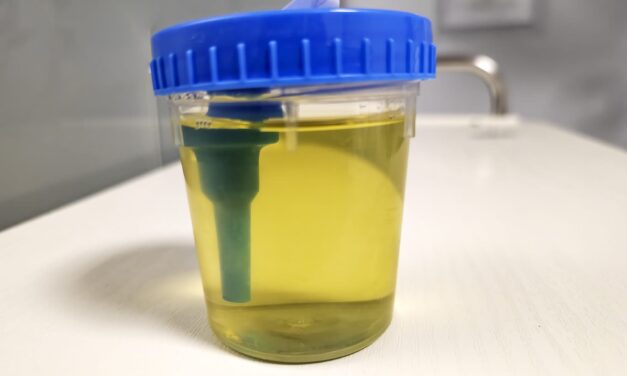 Standardizing Urine Collection Reduced Workflow Disruptions at Middlesex Health
