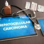 FDA Grants Breakthrough Status to Liquid Biopsy for Liver Cancer Monitoring