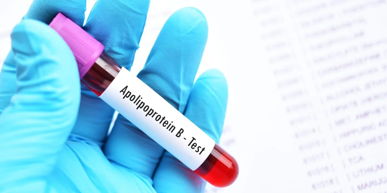 Alternative Blood Test More Effective for Guiding Heart Disease Treatment