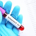 Alternative Blood Test More Effective for Guiding Heart Disease Treatment