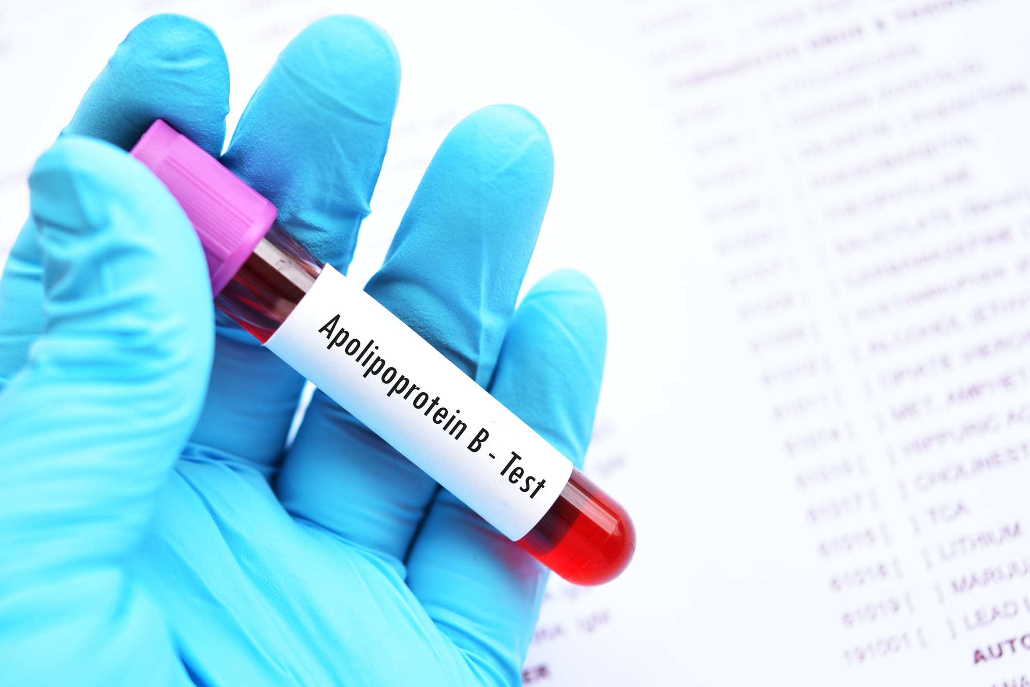 Apolipoprotein B Testing Test More Effective for Guiding Heart Disease ...