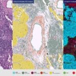 ViewsML to Present Virtual Staining Research at AACR 2026