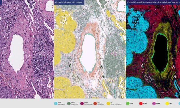 ViewsML to Present Virtual Staining Research at AACR 2026