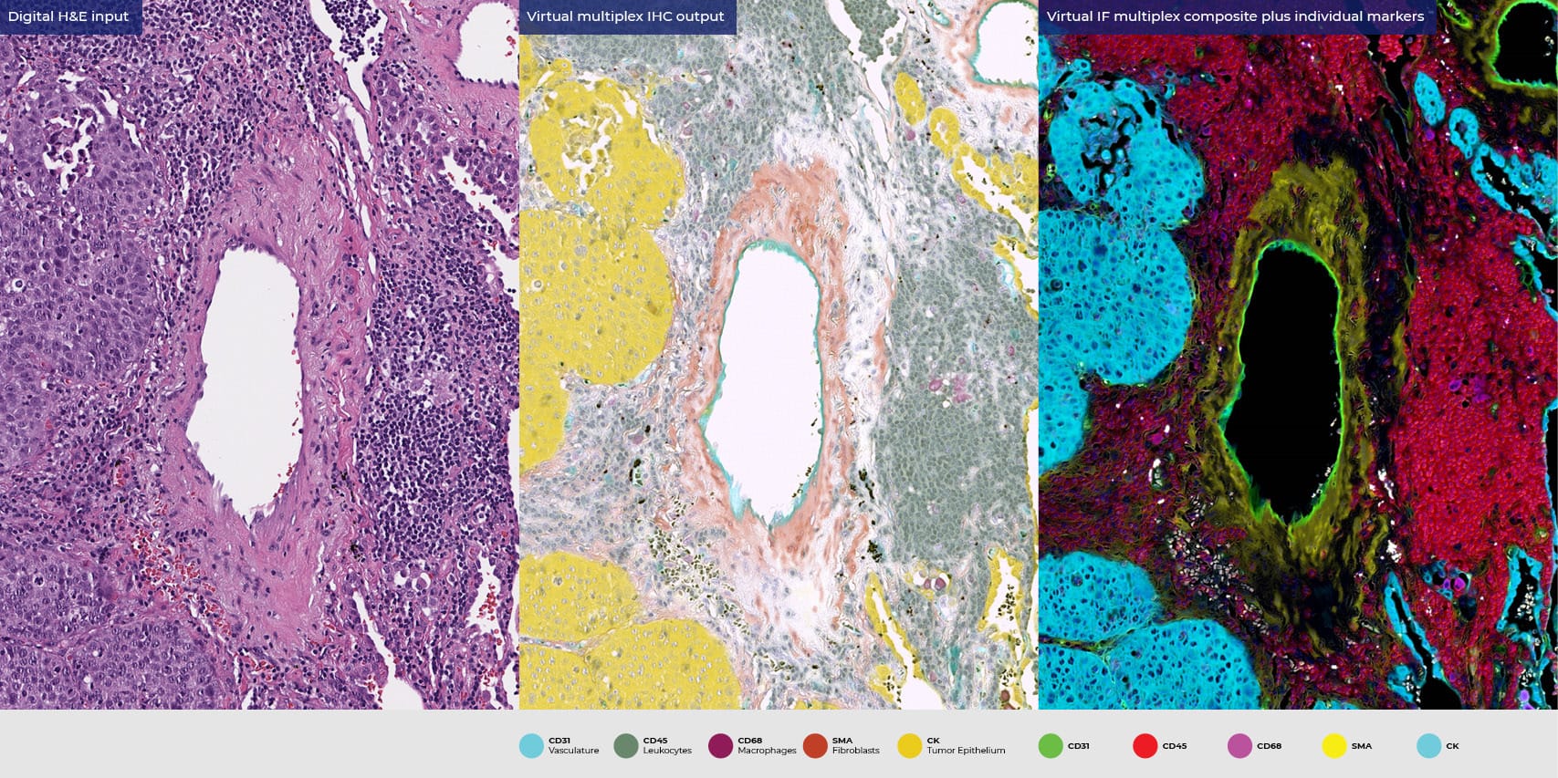 ViewsML to Present Virtual Staining Research at AACR 2026 | Clinical ...