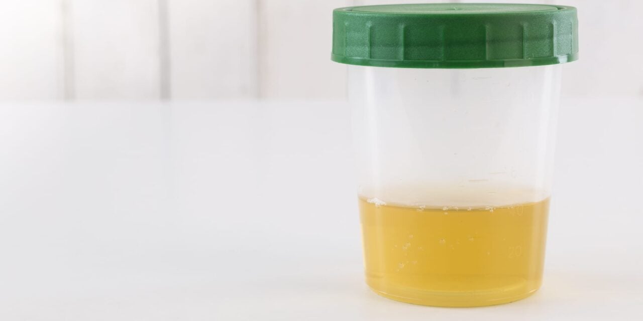 Labcorp’s FDA-Cleared Rapid Fentanyl Urine Test Launches