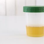 Labcorp’s FDA-Cleared Rapid Fentanyl Urine Test Launches