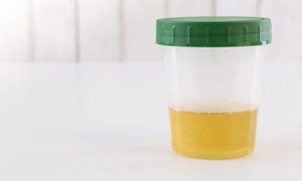 Labcorp’s FDA-Cleared Rapid Fentanyl Urine Test Launches