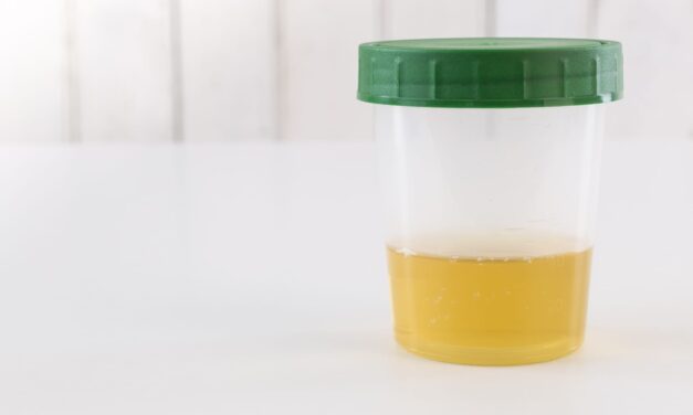 Labcorp’s FDA-Cleared Rapid Fentanyl Urine Test Launches