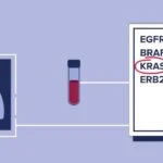 CellCarta Secures Exclusive Global Rights to Deploy Aspyre Lung Assay in Lung Cancer Clinical Trials