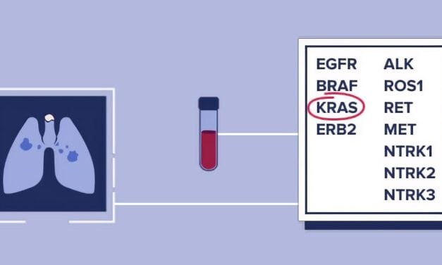 CellCarta Secures Exclusive Global Rights to Deploy Aspyre Lung Assay in Lung Cancer Clinical Trials