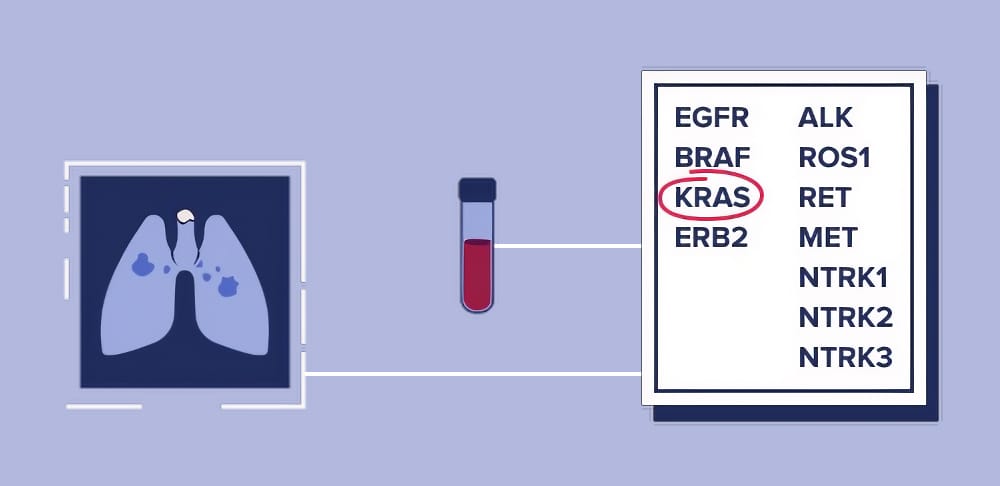CellCarta Secures Exclusive Global Rights to Deploy Aspyre Lung Assay in Lung Cancer Clinical Trials