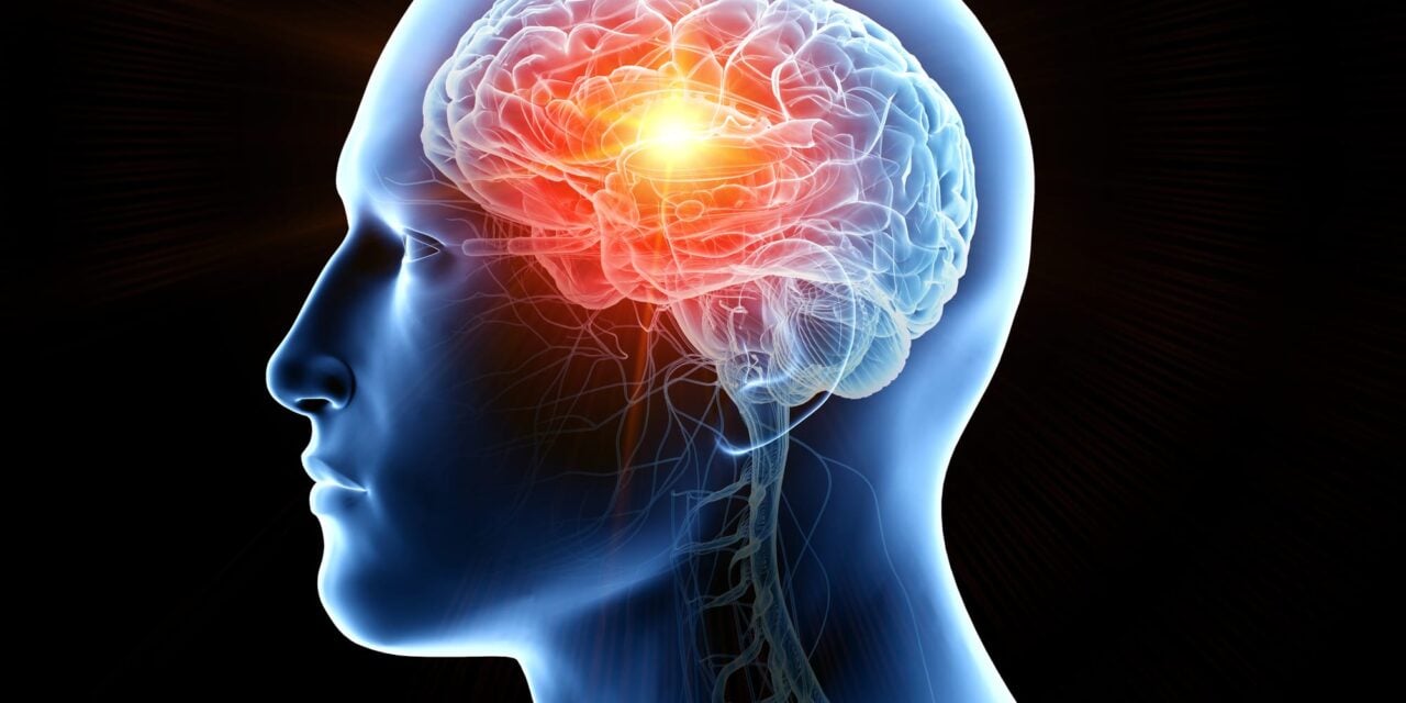 Blood Test Shows Promise for Detecting Glioblastoma Using microRNA Signatures