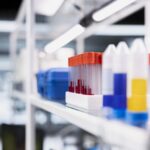 New Blood Test Detects Active and Infectious Tuberculosis