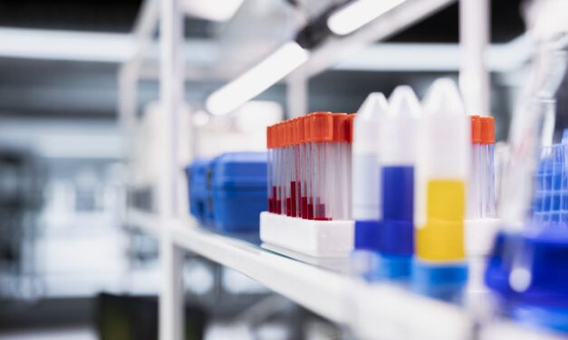 New Blood Test Detects Active and Infectious Tuberculosis