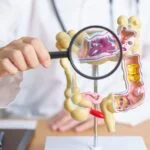 Creatv Bio’s Liquid Biopsy Test Supports CytoDyn Phase 2 Colorectal Cancer Study