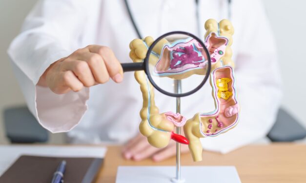 Creatv Bio’s Liquid Biopsy Test Supports CytoDyn Phase 2 Colorectal Cancer Study