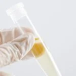 Study Validates Next-Generation Sequencing Test for Urinary Tract Infections