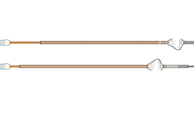 New Endometrial Sampling Device Receives FDA Clearance for Cancer Detection