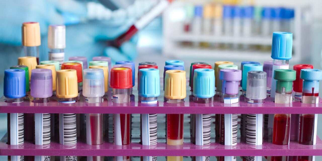 New Clinical Data Supports Blood-Based Monitoring for Cancer Treatment Response