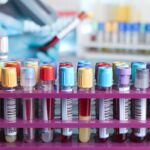 New Clinical Data Supports Blood-Based Monitoring for Cancer Treatment Response
