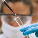 Researchers Develop Blood Test That May Detect Testicular Cancer Missed by Standard Markers
