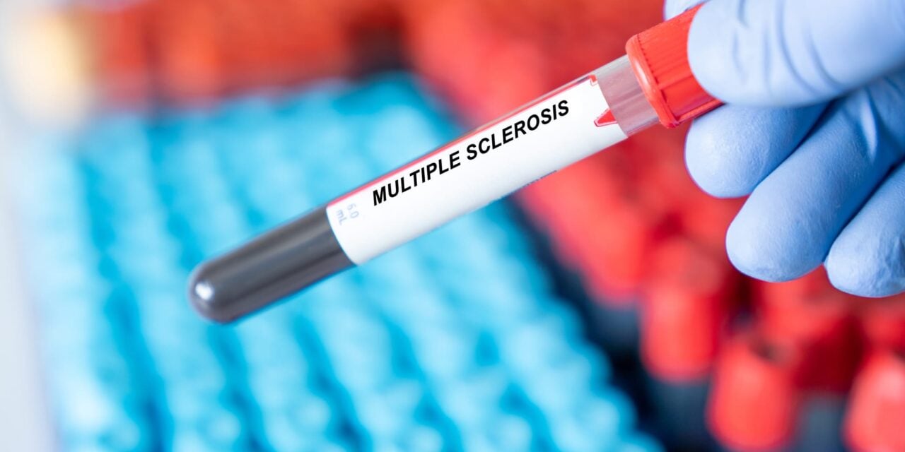 Roche Receives CE Mark for Multiple Sclerosis Blood Test