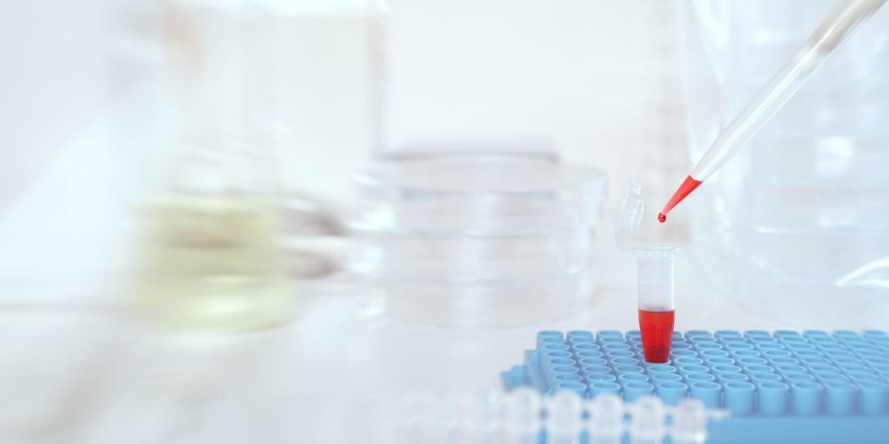 CareDx to Acquire Oncology Diagnostics Company Naveris for $160 Million