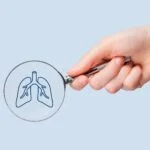 Caris Life Sciences AI Algorithm Flags Potential Cancer Misdiagnoses in Lung Cancer Study