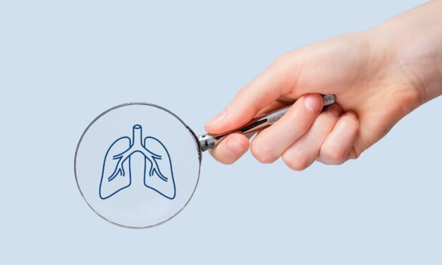 Caris Life Sciences AI Algorithm Flags Potential Cancer Misdiagnoses in Lung Cancer Study