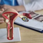 Labcorp Launches Companion Diagnostic for Ovarian Cancer Treatment