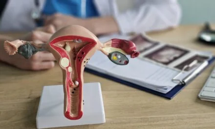 Labcorp Launches Companion Diagnostic for Ovarian Cancer Treatment