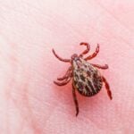 Common Lyme Disease Tests Miss Majority of Early Cases, Study Finds