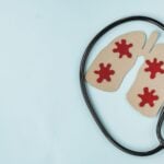 Study Finds Undiagnosed Tuberculosis DNA in US Patients Using Ultrasensitive Test