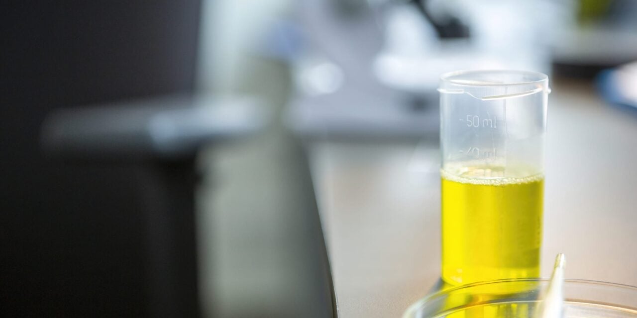 Urine-Based Liquid Biopsy Shows High Sensitivity for Prostate Cancer Detection