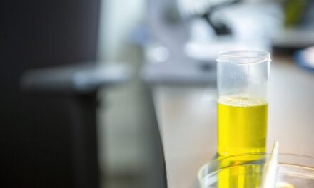 Urine-Based Liquid Biopsy Shows High Sensitivity for Prostate Cancer Detection