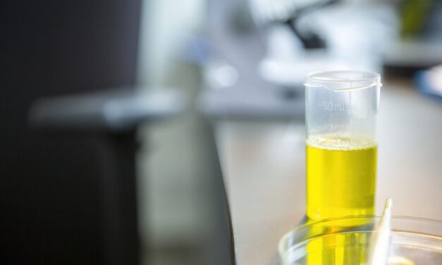 Urine-Based Liquid Biopsy Shows High Sensitivity for Prostate Cancer Detection