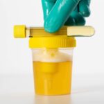 EpiCapture Urine-Based Prostate Cancer Test Shows High Accuracy in Clinical Study