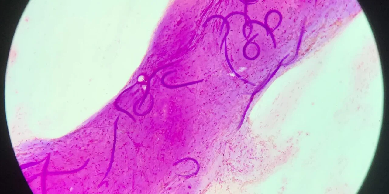 FDA Clears Customizable Gastrointestinal Pathogen Assay