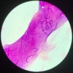 FDA Clears Customizable Gastrointestinal Pathogen Assay