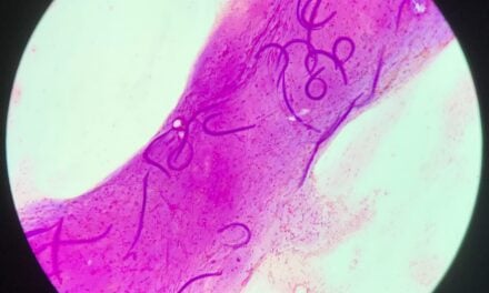 FDA Clears Customizable Gastrointestinal Pathogen Assay
