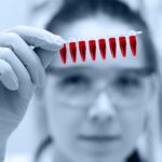 Liquid Biopsy Predicts Immunotherapy Response in Breast Cancer, Study Shows