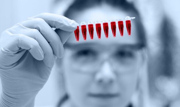 Liquid Biopsy Predicts Immunotherapy Response in Breast Cancer, Study Shows