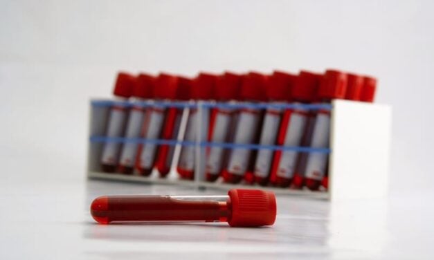 Roche Receives CE Mark for Alzheimer’s Disease Blood Test