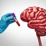 Alzheimer’s Blood-Based Biomarker Testing Integrated into Clinical Workflows