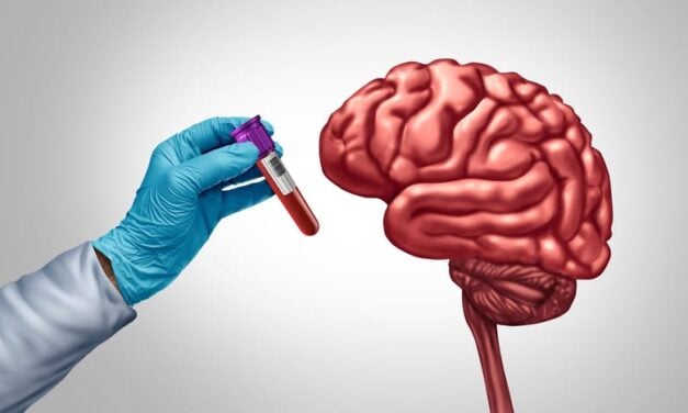 Alzheimer’s Blood-Based Biomarker Testing Integrated into Clinical Workflows