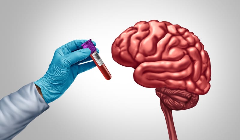 Alzheimer’s Blood-Based Biomarker Testing Integrated into Clinical Workflows