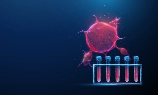 Liquid Biopsy of Tumor Microenvironment Predicts Cancer Therapy Response